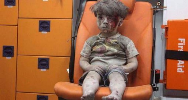 Ambulansta yalnız çocuğun yürek parçalayan görüntüsü Halep'in günlük kabusunu gösteriyor