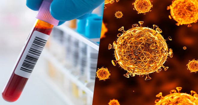 Bilim insanları AIDS'e neden olan HIV virüslü hücreleri ilk kez imha etmeyi bașardı