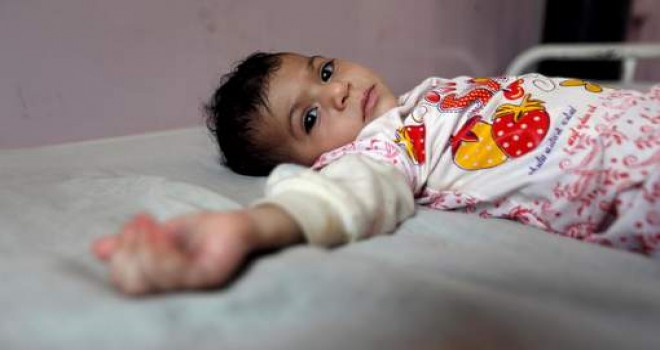 Yemen kıtlık eşiğinde: İki milyon çocuk akut yetersiz beslenmeden muzdarip